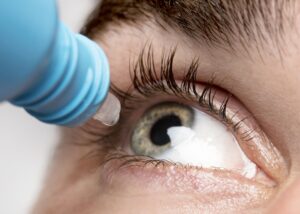 Conjuntivite de inverno: como proteger seus olhos