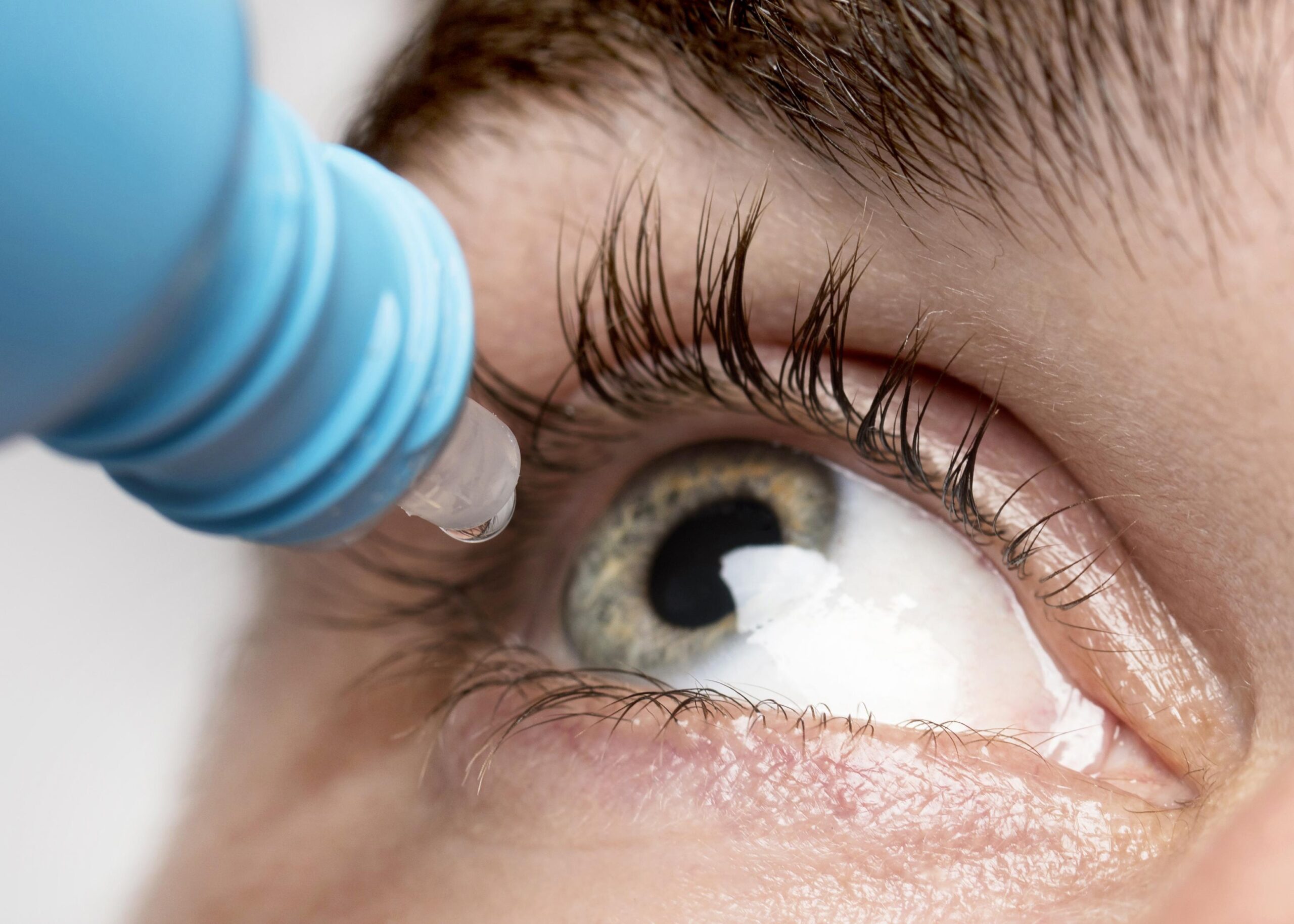 Conjuntivite de inverno: como proteger seus olhos